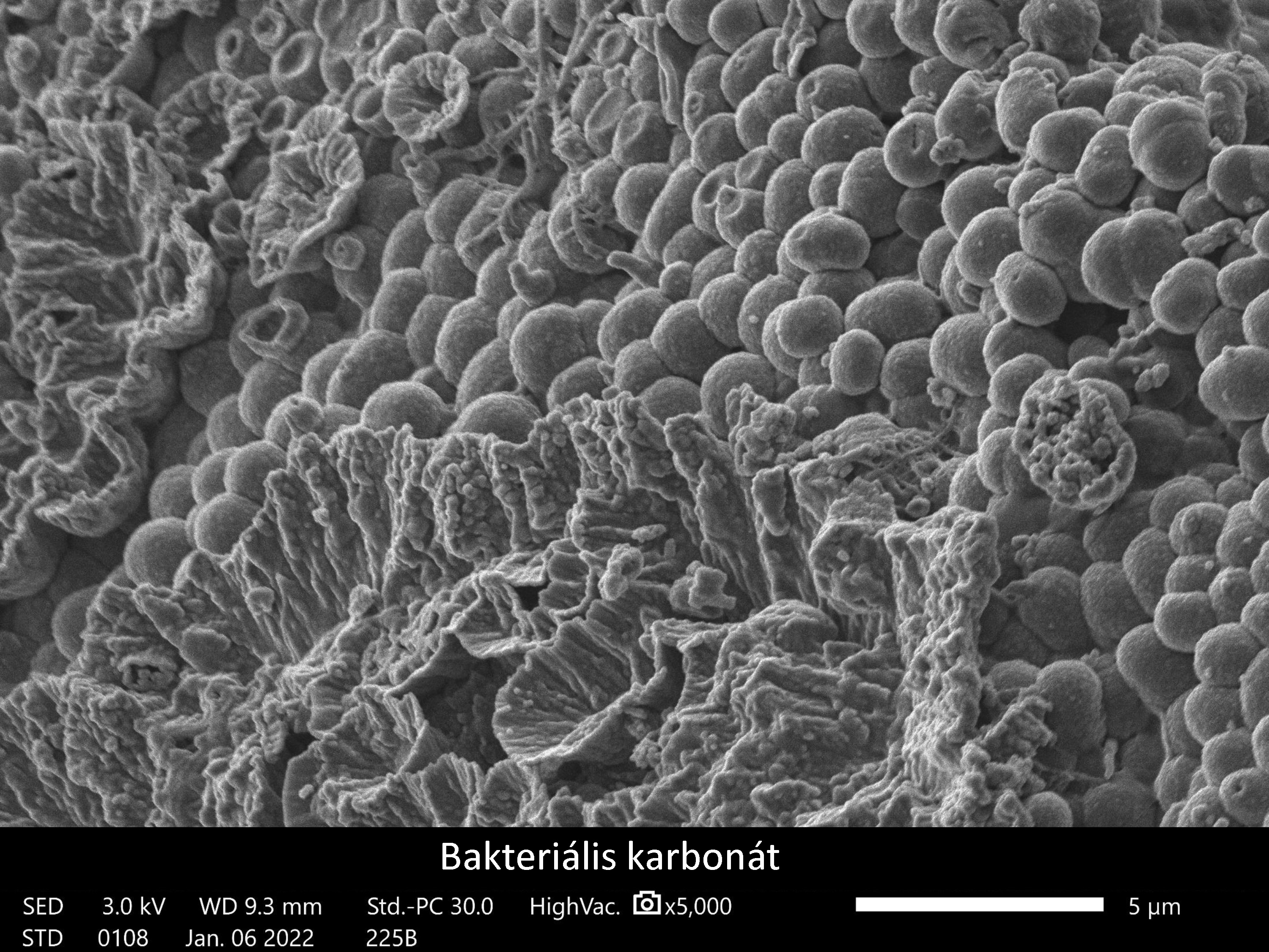 Bakteriális karbonát